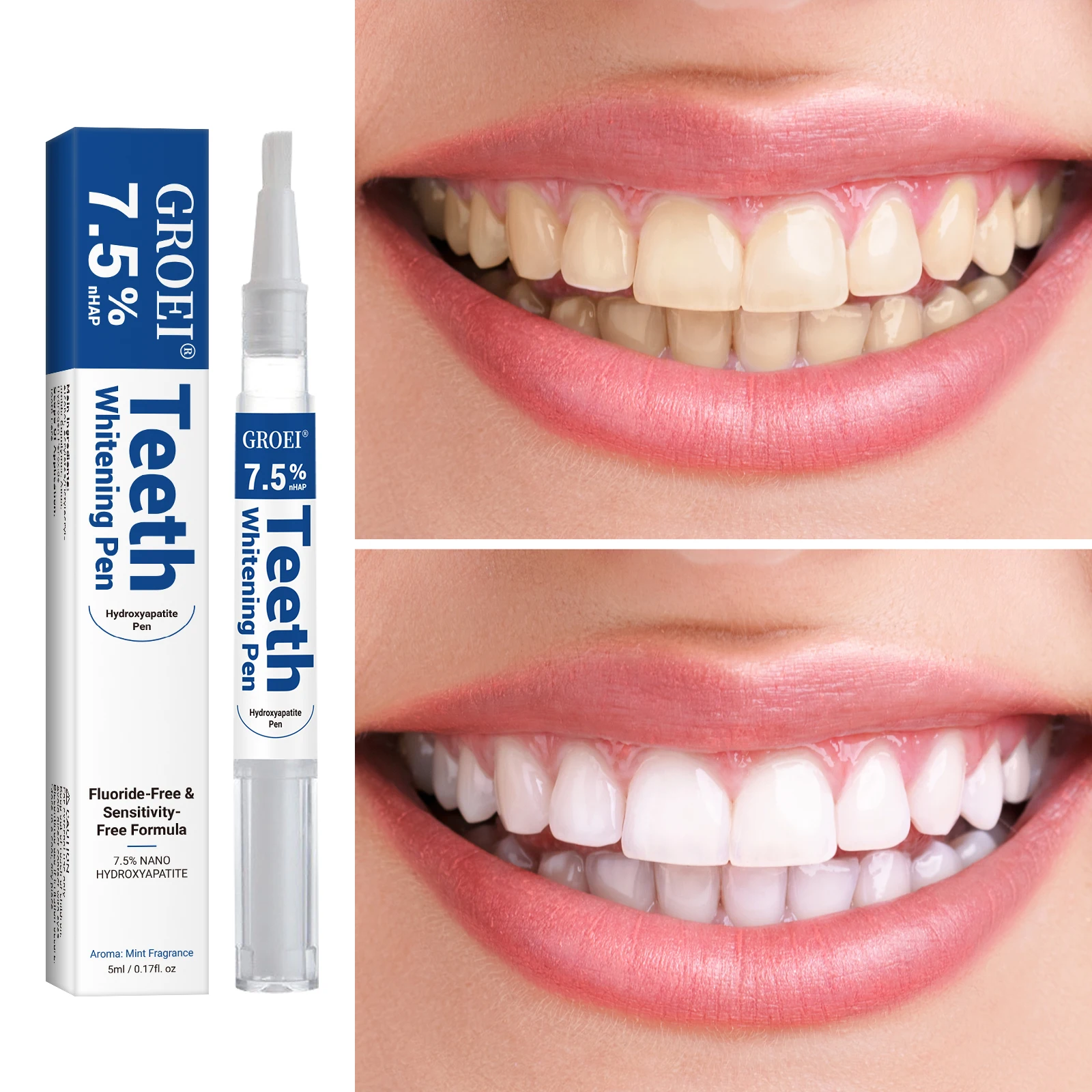 Hydroxyapatite Tooth Whitening - đánh giá và giá Teeth Whitening Gel Peroxide