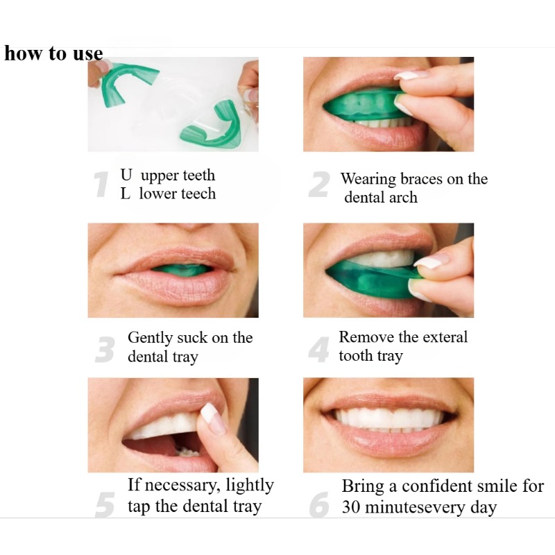 Set Teeth Whitening Tray U-sha - đánh giá và giá Teeth Whitening With Trays