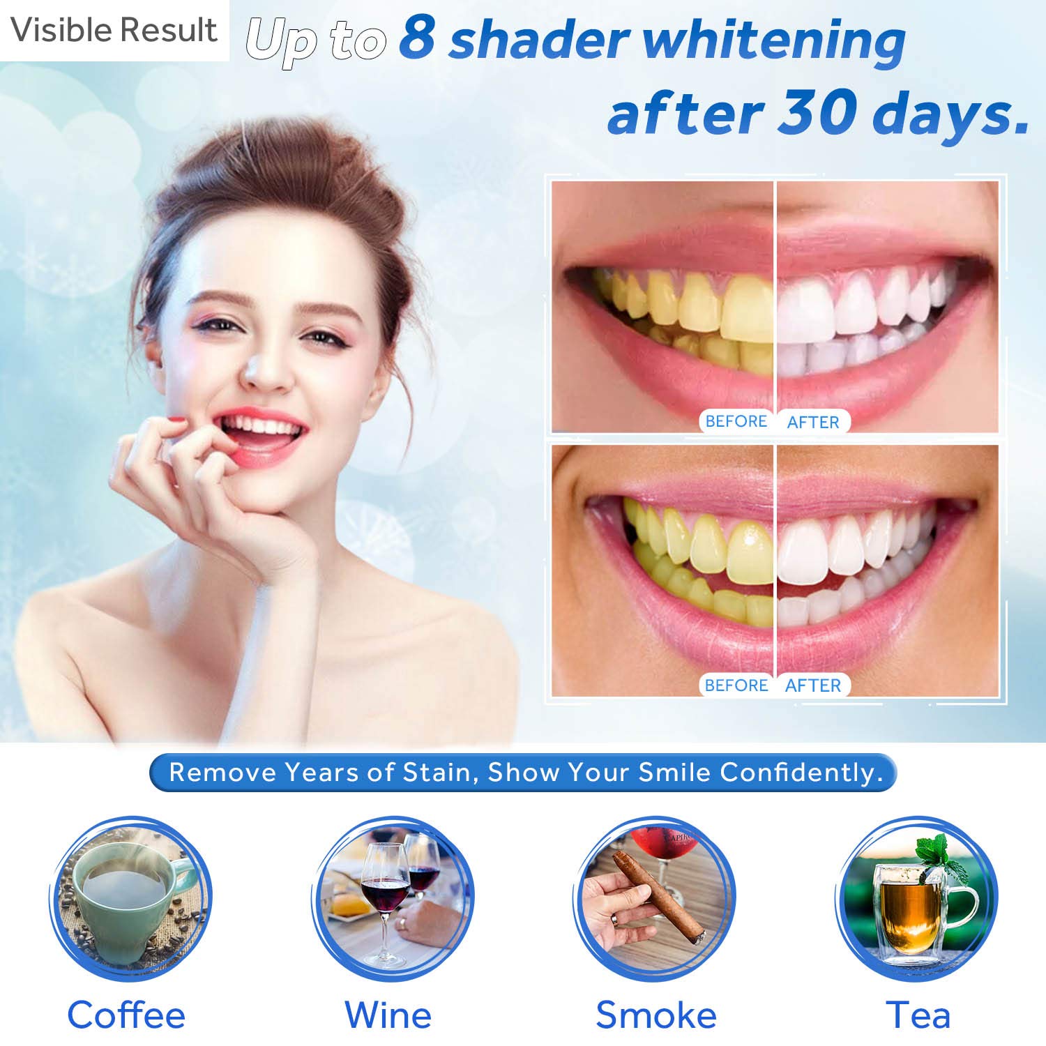 Teeth Whitening Gel Refill Syr - đánh giá và giá Teeth Whitening Gel Peroxide