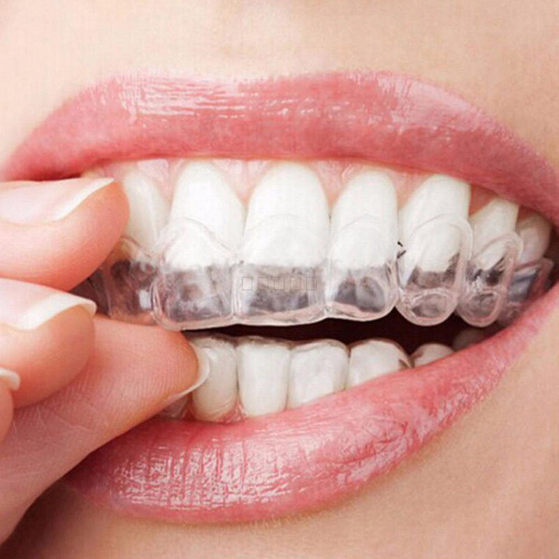 1 Trong Suốt Dập Xù Làm Trắng  - đánh giá và giá Teeth Whitening With Trays
