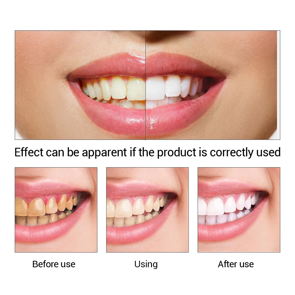 FTEENPLY Làm Trắng Răng Tinh C - đánh giá và giá Teeth Whitening Paste