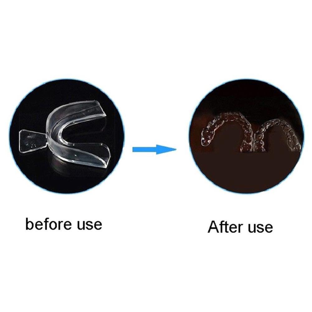 Silicone Mouth Guard Orthodont - đánh giá và giá Teeth Whitening With Trays