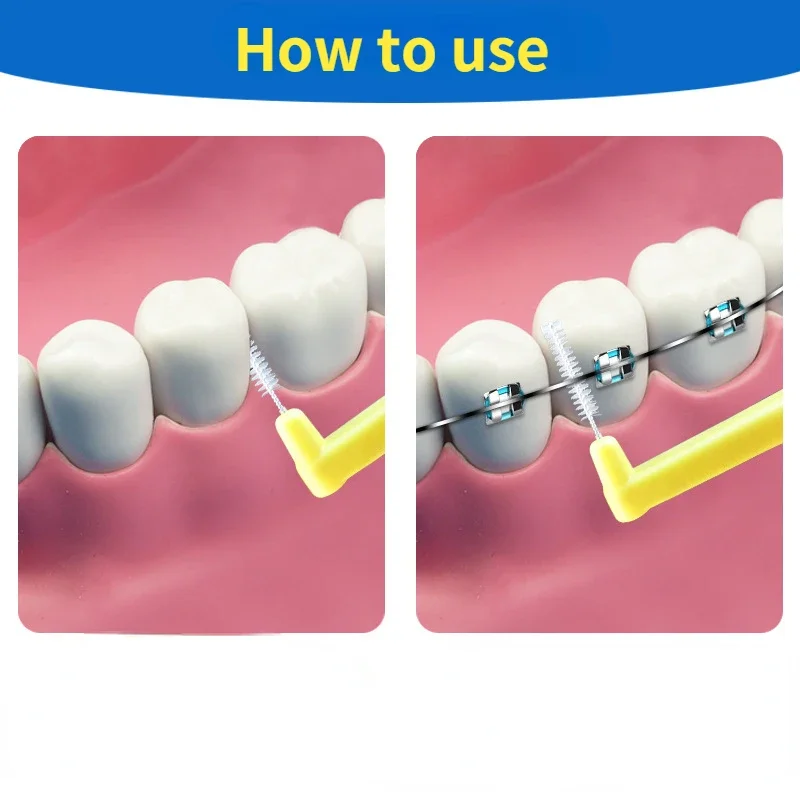 10Pcs L Shape Push-Pull Interd - đánh giá và giá Teeth Whitening Brush