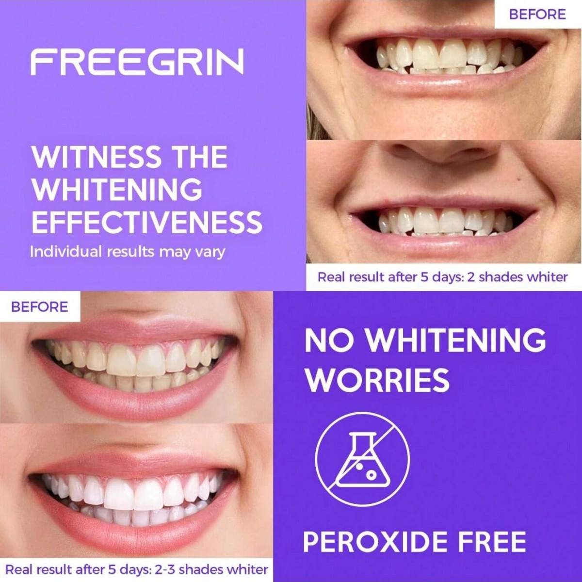 Deluxe Whitening Teeth Sticker - đánh giá và giá Teeth Whitening Gel Peroxide