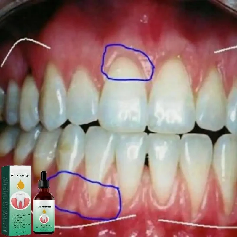 Gum Repair Drops Relieve Reced - đánh giá và giá Teeth Whitening Paste