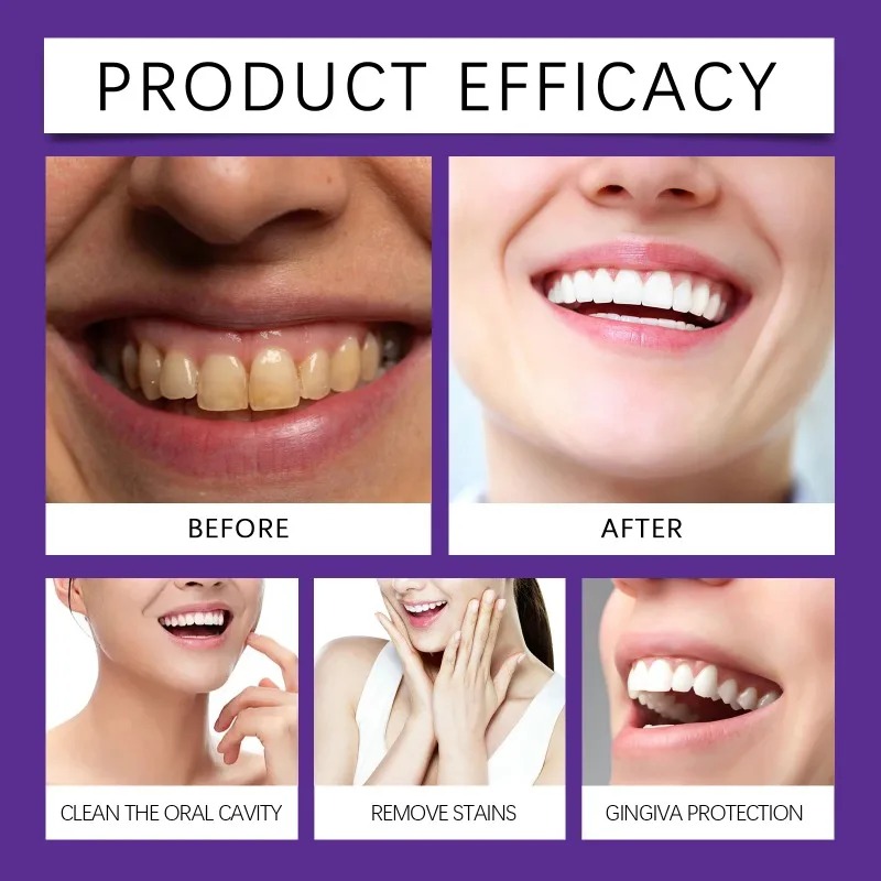 Purple Teeth Restoration Miner - đánh giá và giá Teeth Whitening Zimba